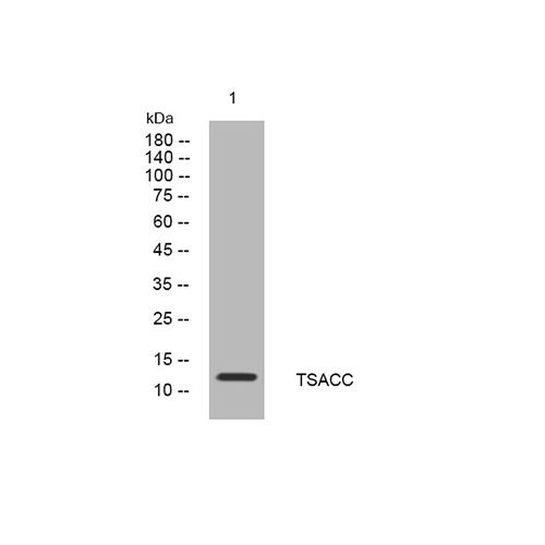 英國St John's Laboratory生物公司STJ194378-200ug產(chǎn)品介紹