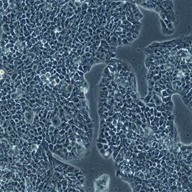 人乳腺腺癌細胞HCC1428（STR鑒定正確）