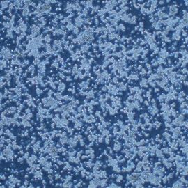 人淋巴母細胞EBV轉化HCC38 BL  (STR正確)