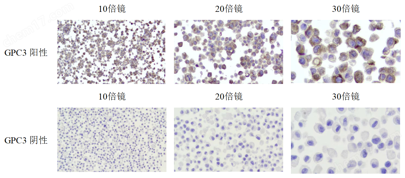 GPC3 陰陽二合一 石蠟撈片標(biāo)準(zhǔn)品