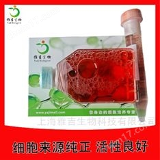 人甲狀腺癌細(xì)胞ARO（未分化）