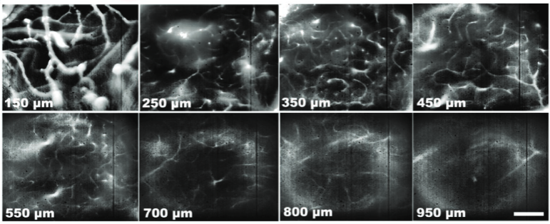 近紅外熒光成像顯微鏡應(yīng)用
