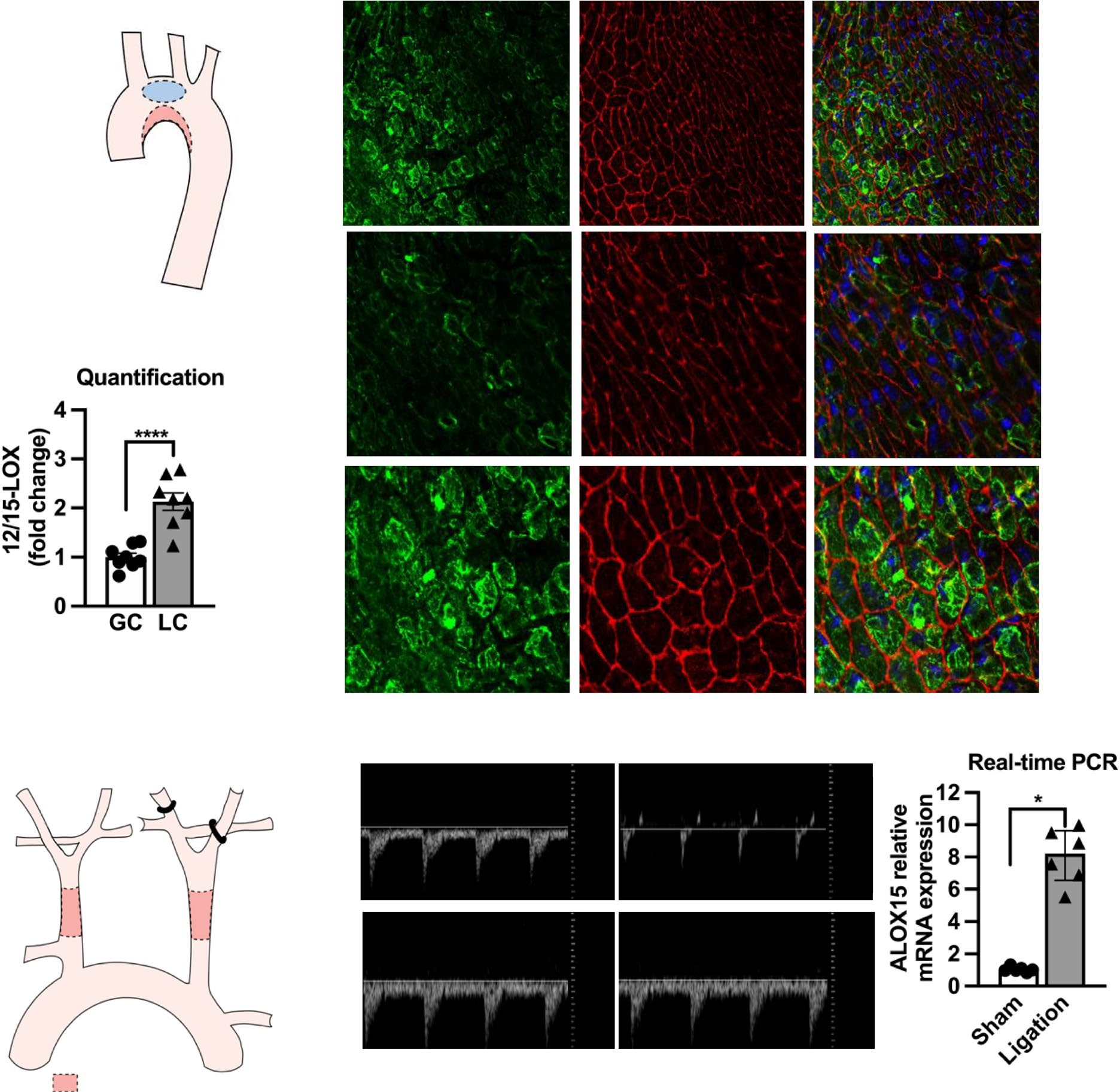 12/15-脂氧合酶介导血流紊乱诱导的内皮功能障碍与动脉粥样硬化
