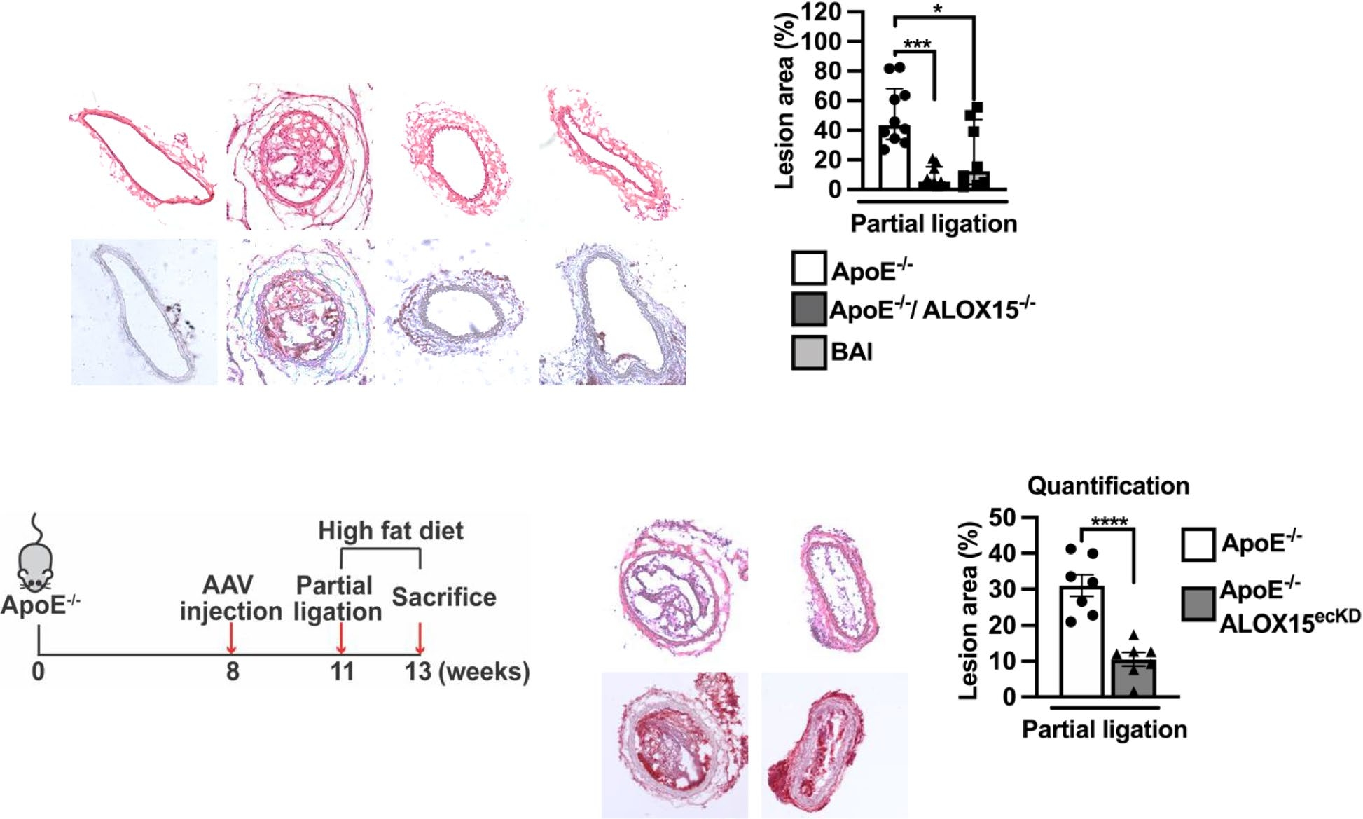 12/15-脂氧合酶介导血流紊乱诱导的内皮功能障碍与动脉粥样硬化