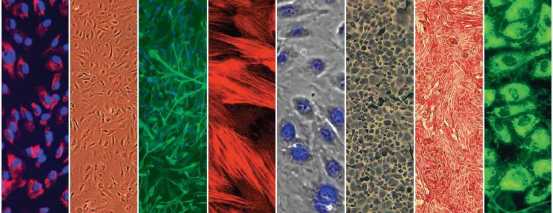 image.png LONZA原代人表皮角质形成细胞NHEK, Human Epidermal Keratinocytes产品介绍