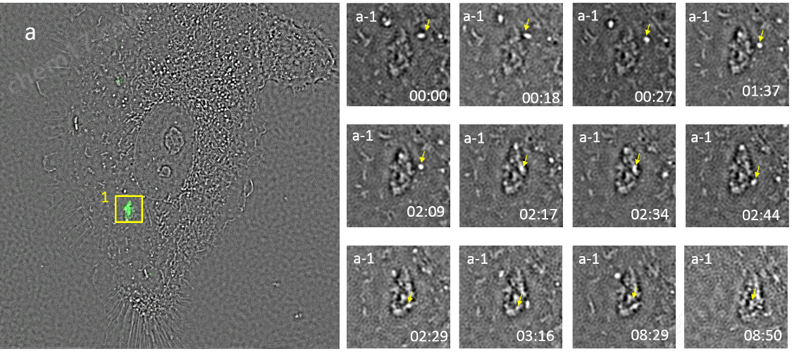 6.png 超分辨熒光-傅里葉無(wú)標(biāo)記顯微鏡