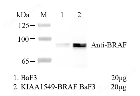 KIAA1549-BRAF/BaF3